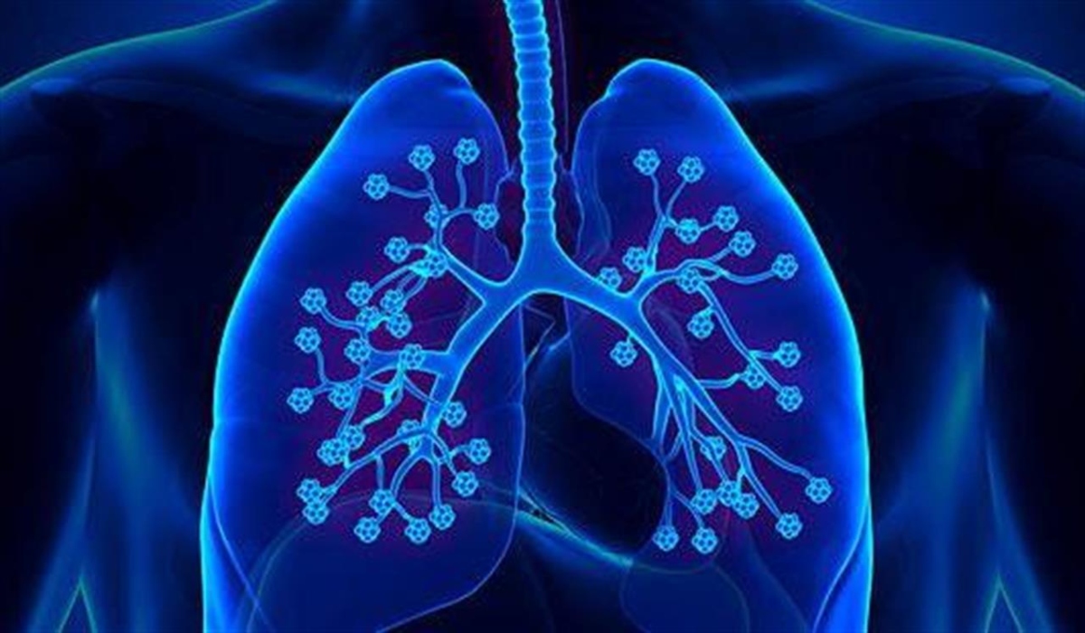 45935-lungs-pneymones-penvmones-214