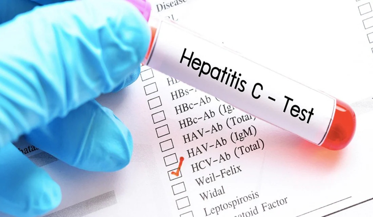 header-hepatitis-c-test-ipatitida-c-0906
